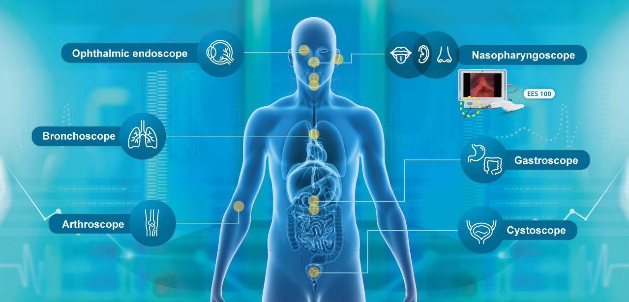 Medical Endoscope